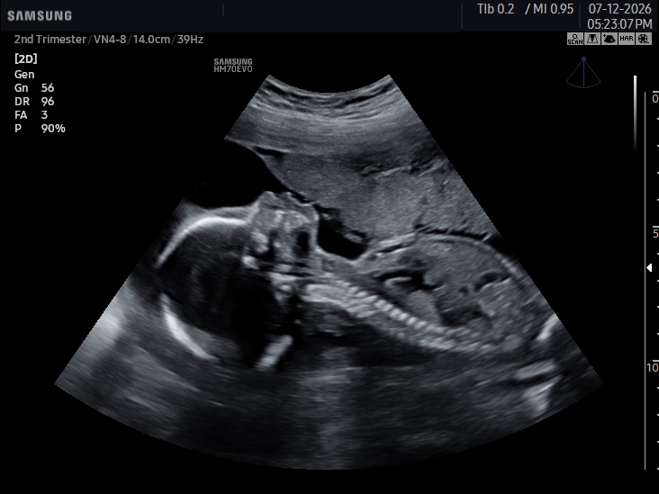 2D ultrasound image