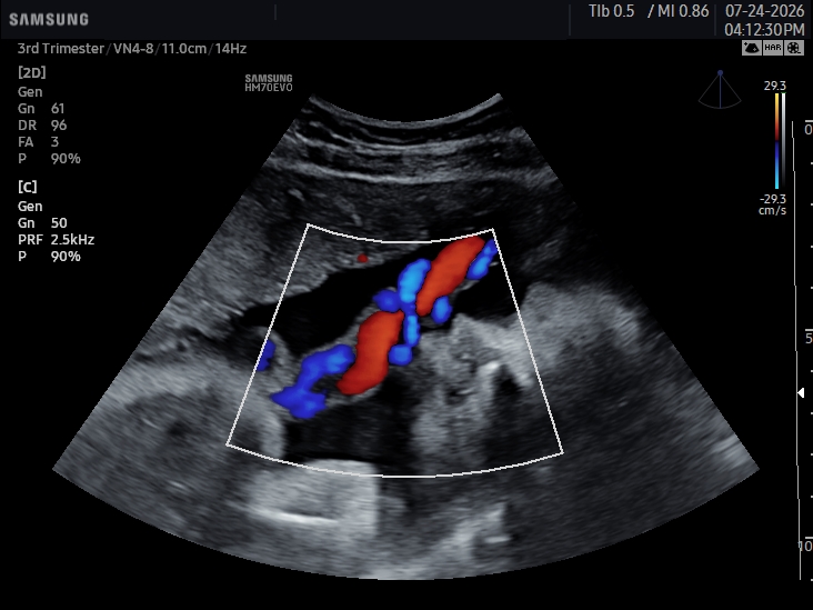 2D ultrasound image