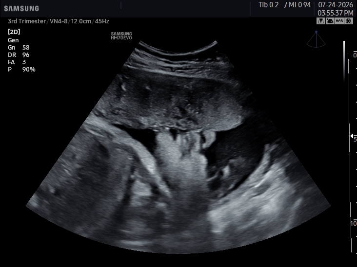 2D ultrasound image