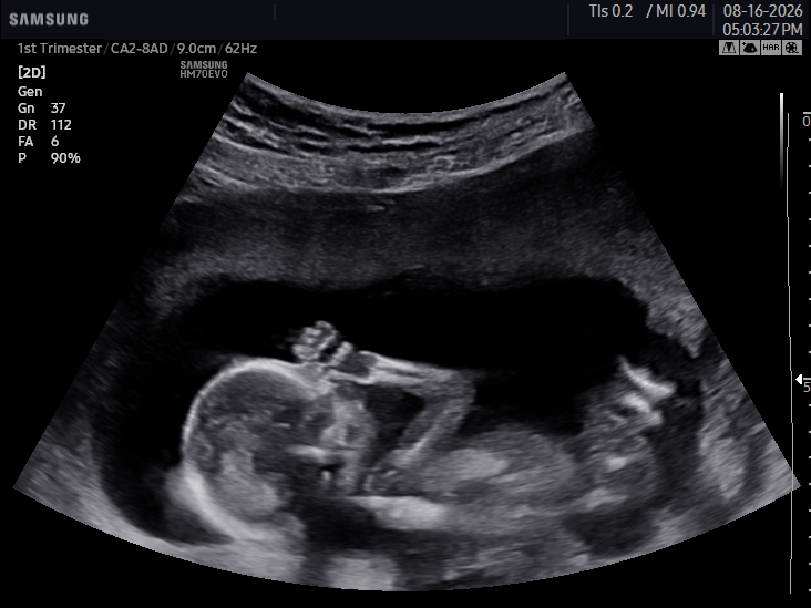 2D ultrasound image
