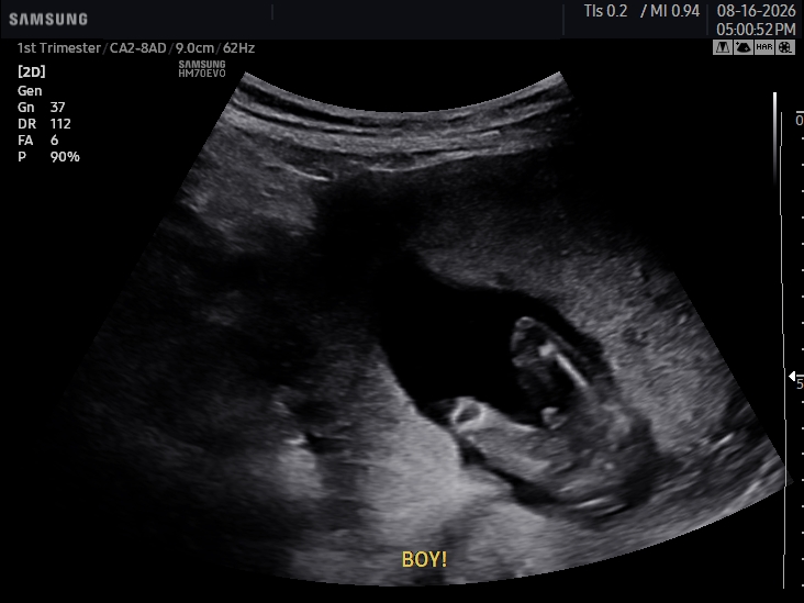 2D ultrasound image