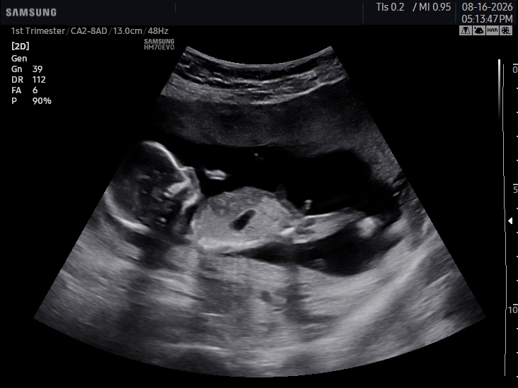 2D ultrasound image