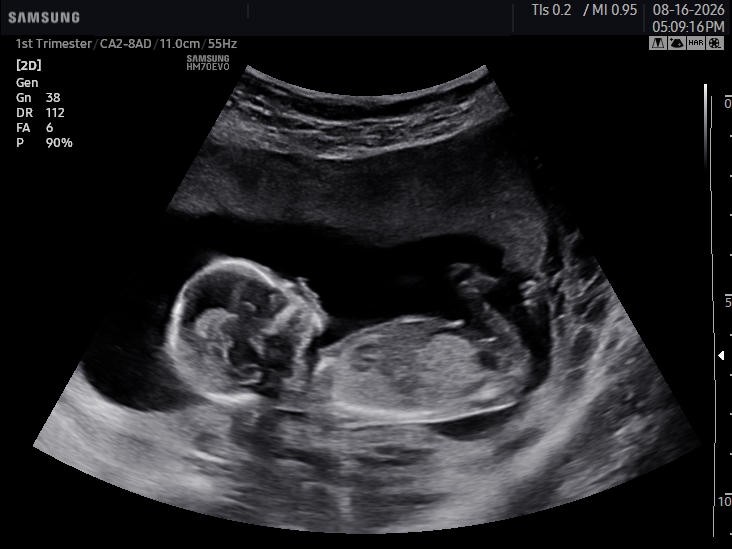 2D ultrasound image
