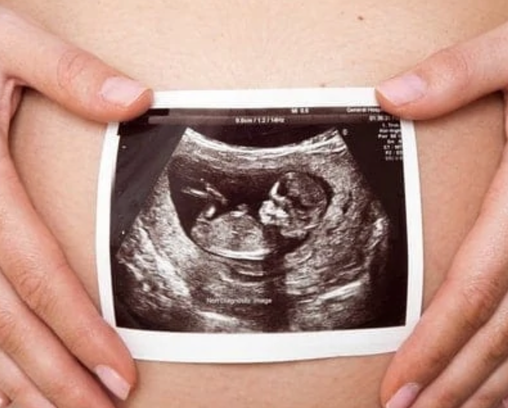 2D Ultrasound scan